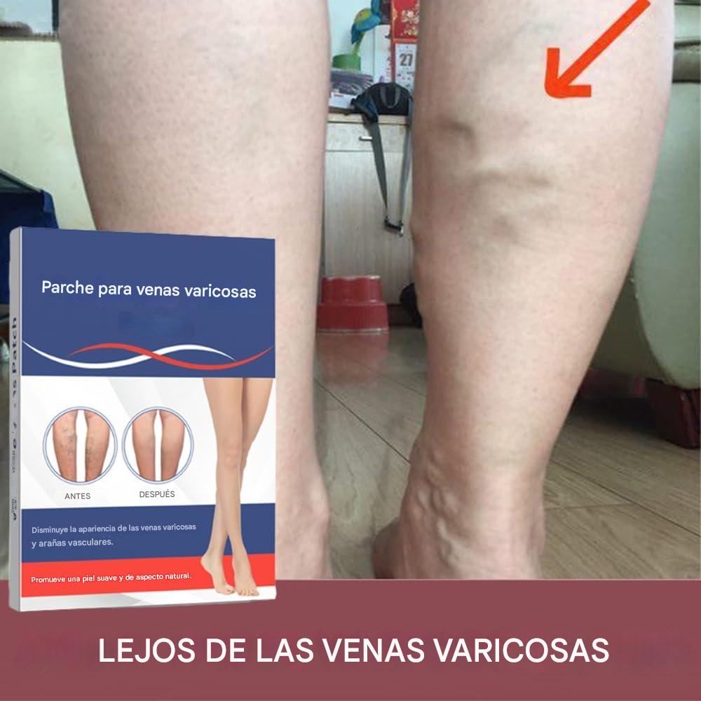 3 CAJAS DE 10 PARCHES PARA VARICES